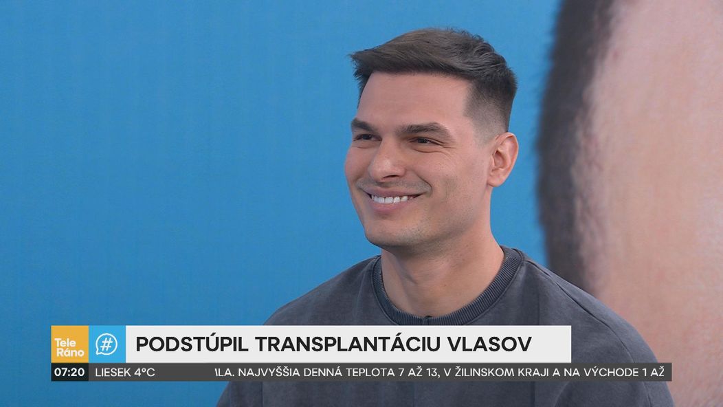Martin Koči rozprával v Teleráne o transplantácii vlasov.