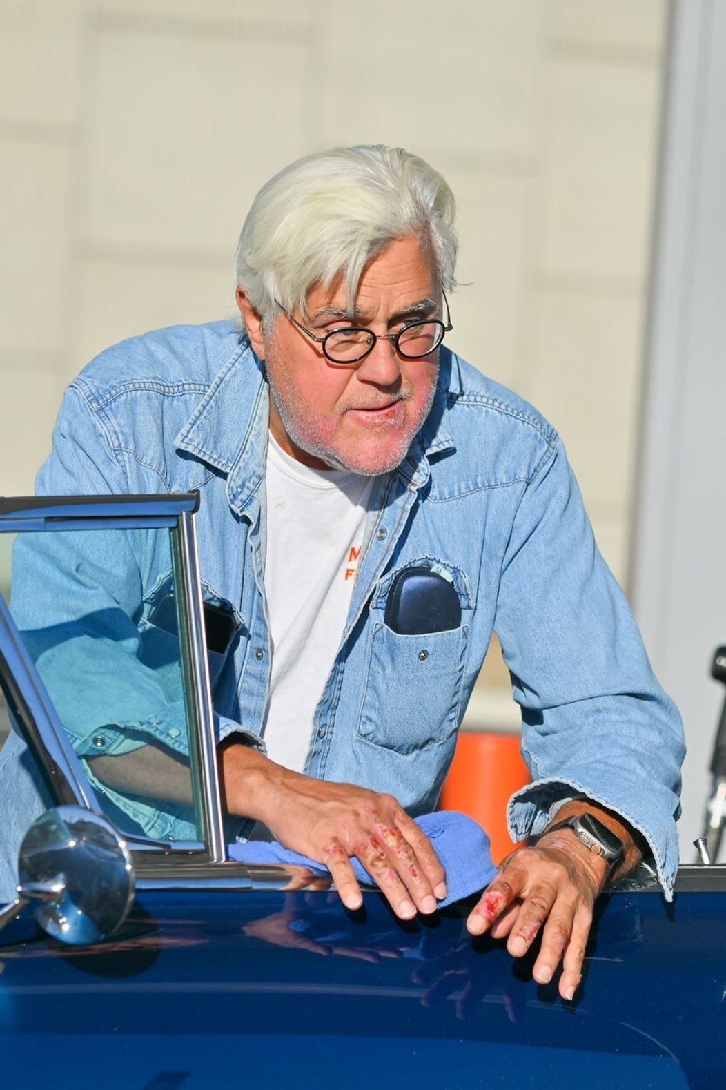 Jay Leno po pobyte v nemocnici