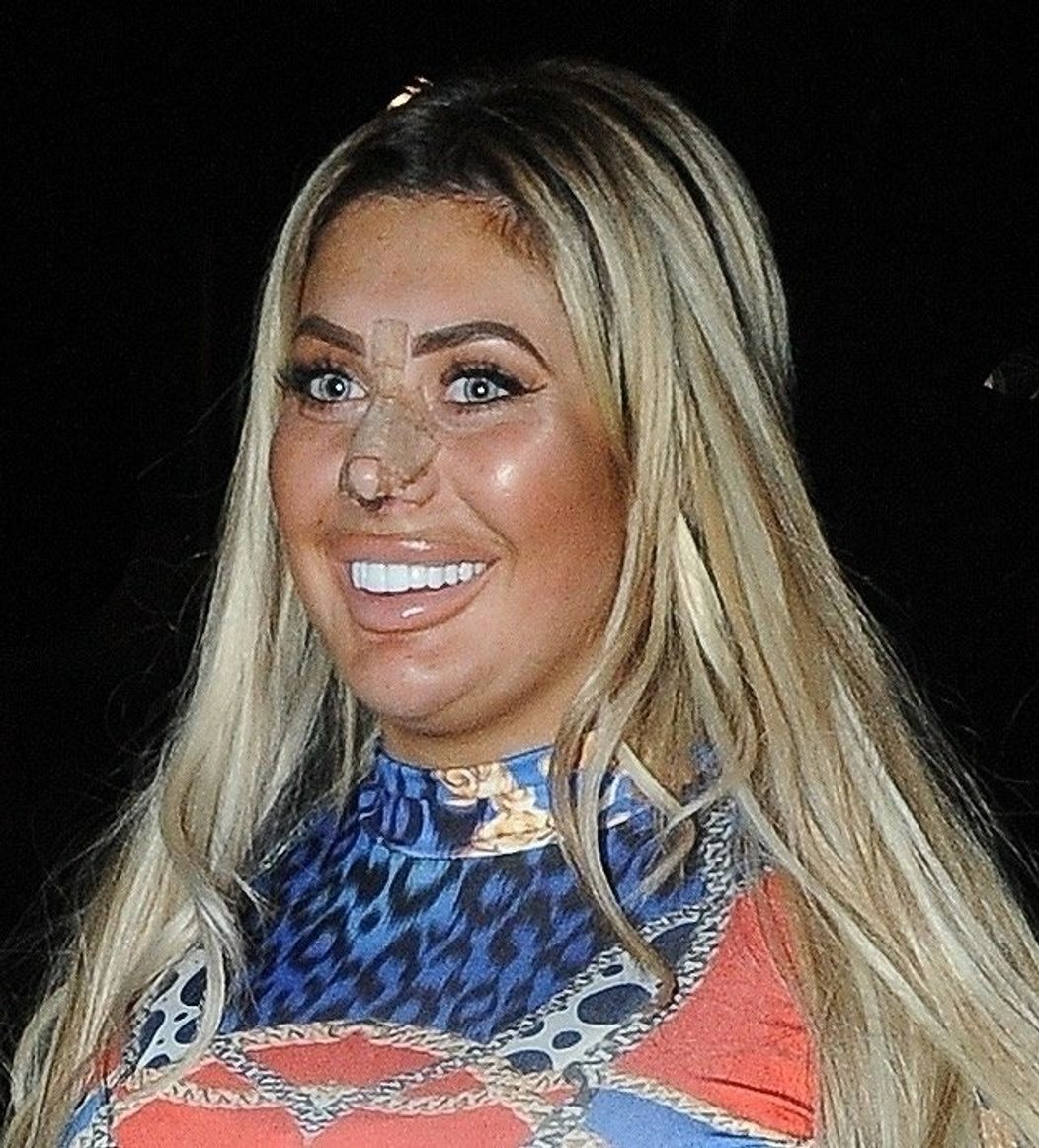 Chloe Ferry po plastike nosa. 