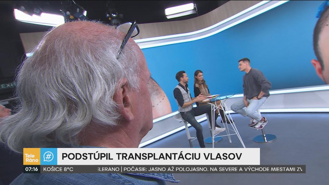 Martin Koči rozprával v Teleráne o transplantácii vlasov.