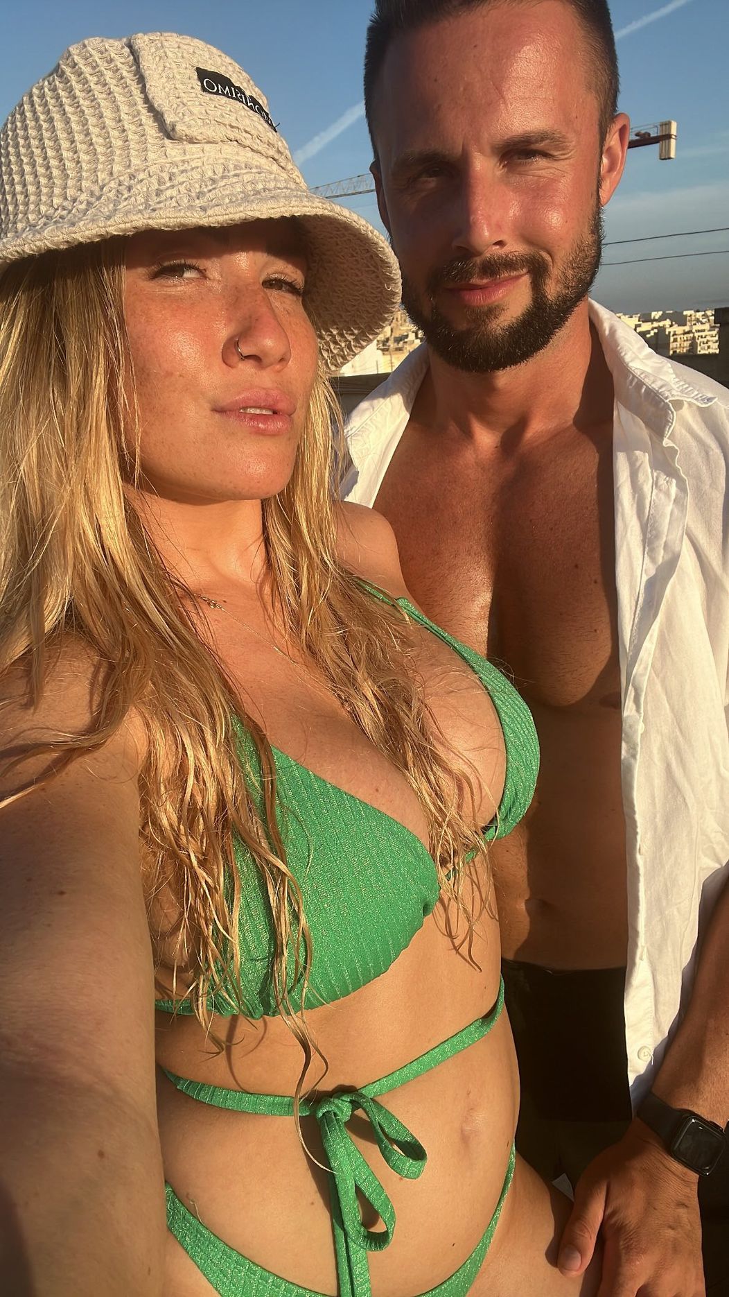 Tereza po plastickej operácii