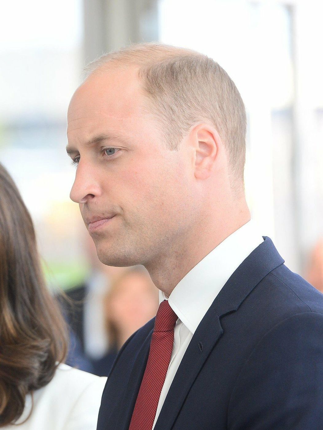 Princ William má nad ľavým obočím jazvu