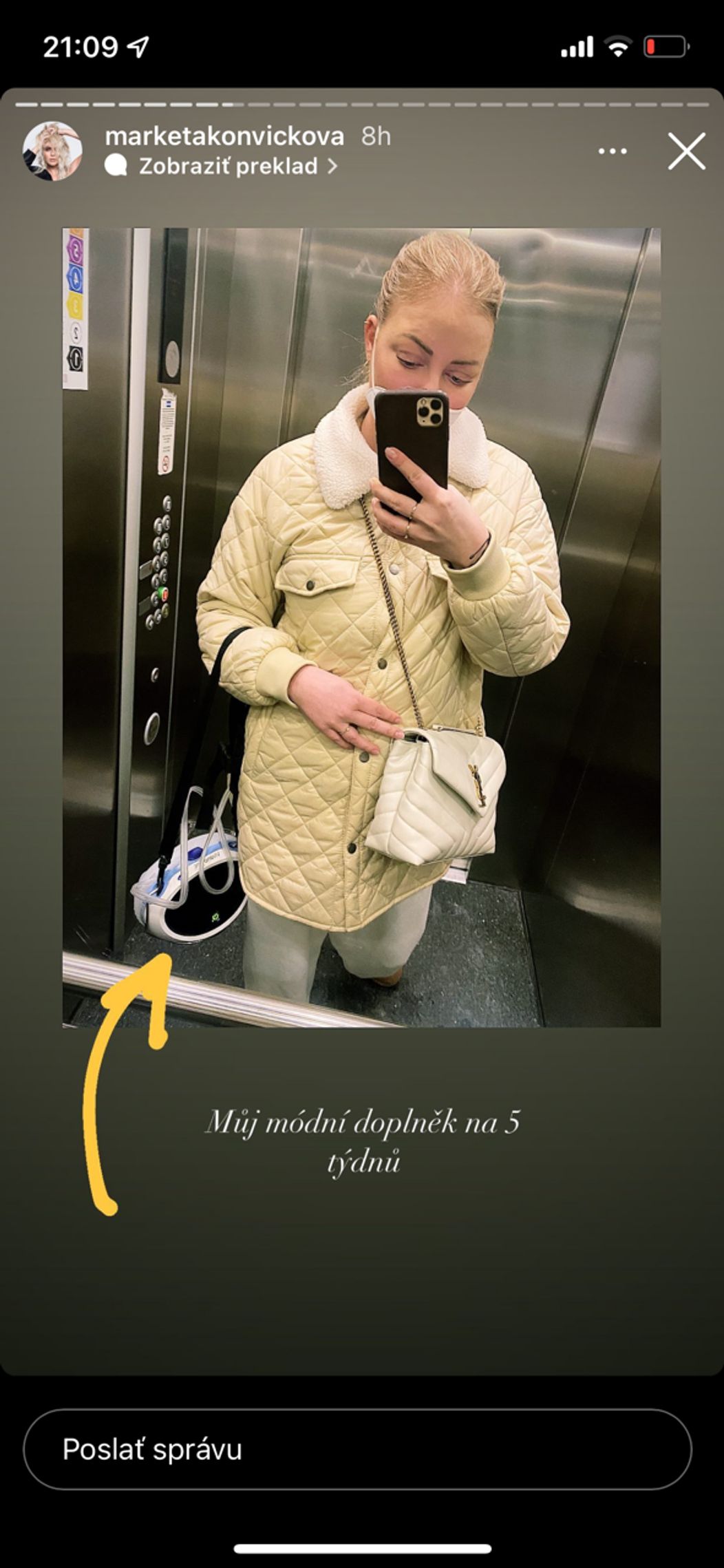 Markéta mala nepríjemné zranenie