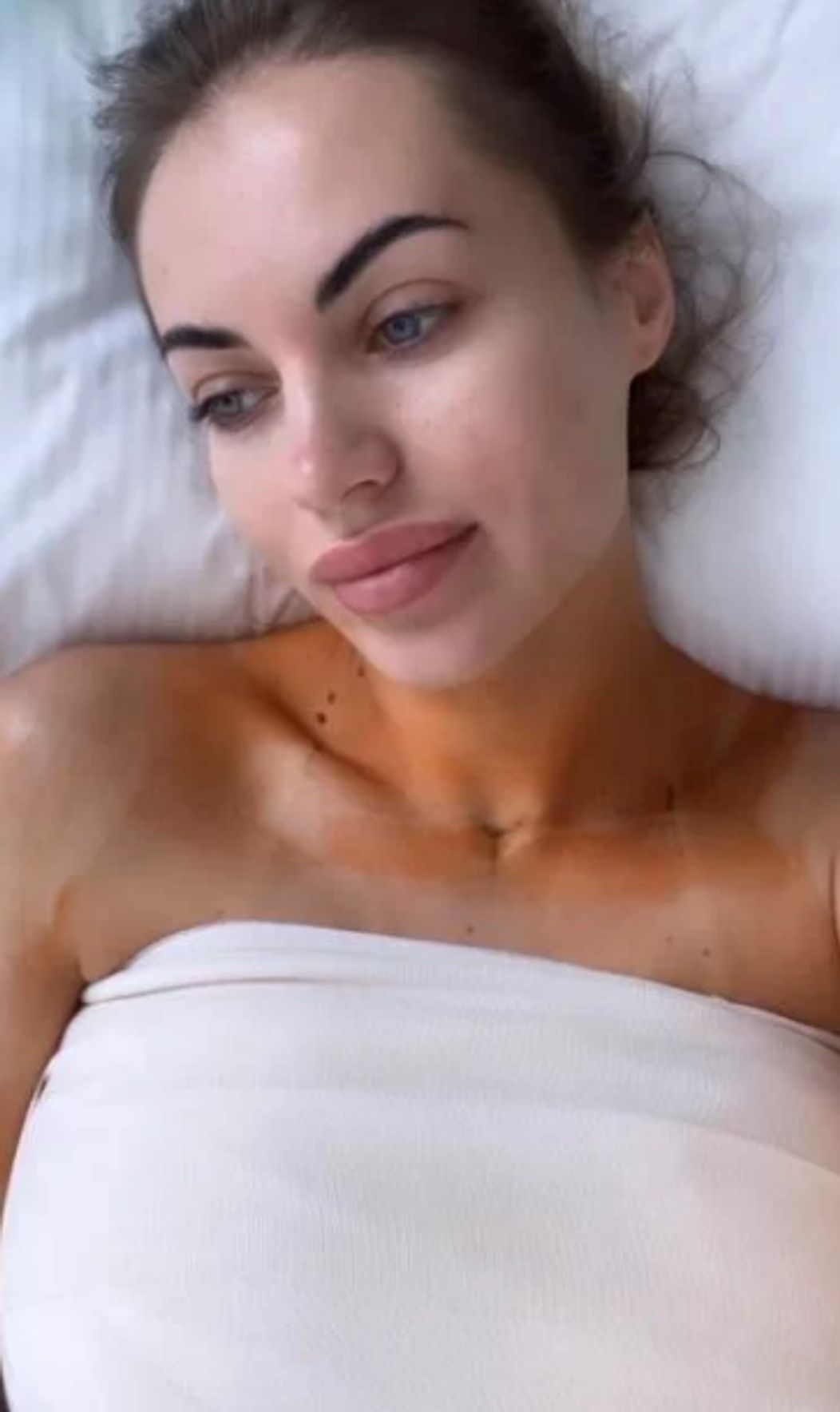 Natálie ukázala po zmenšení poprsia fotky z kliniky.