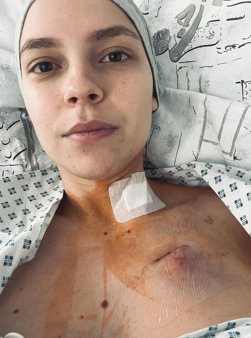Patrícia po operácii v príprave na chemoterapiu.
