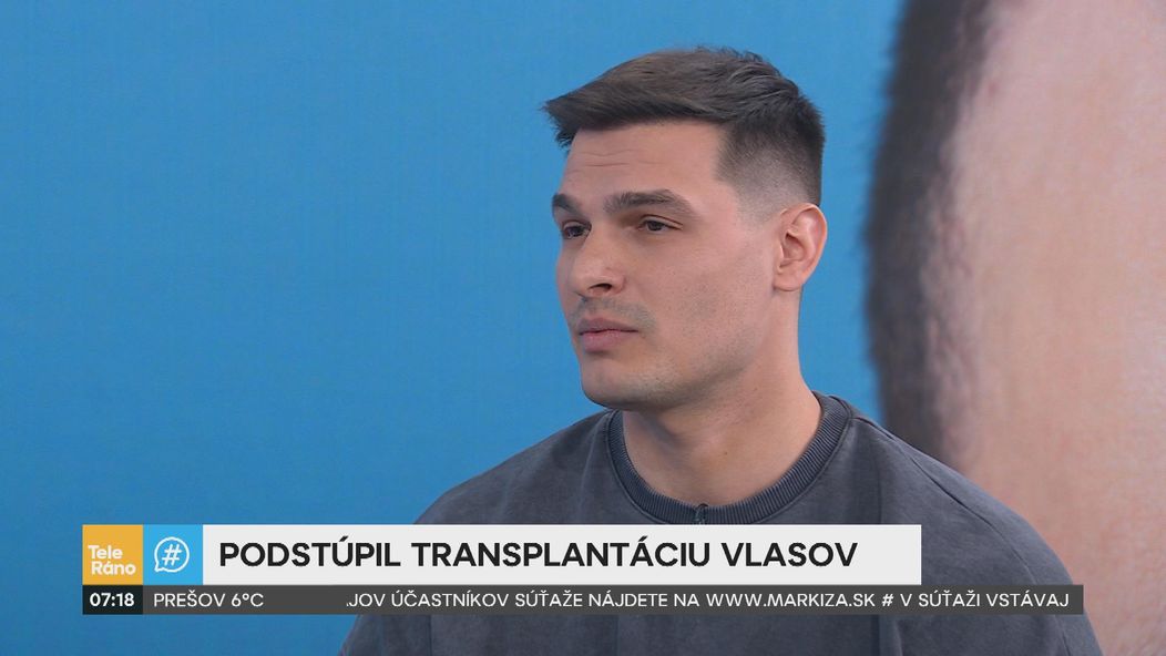Martin Koči rozprával v Teleráne o transplantácii vlasov.