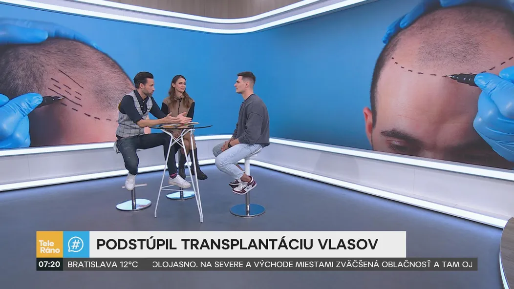 Martin Koči rozprával v Teleráne o transplantácii vlasov.
