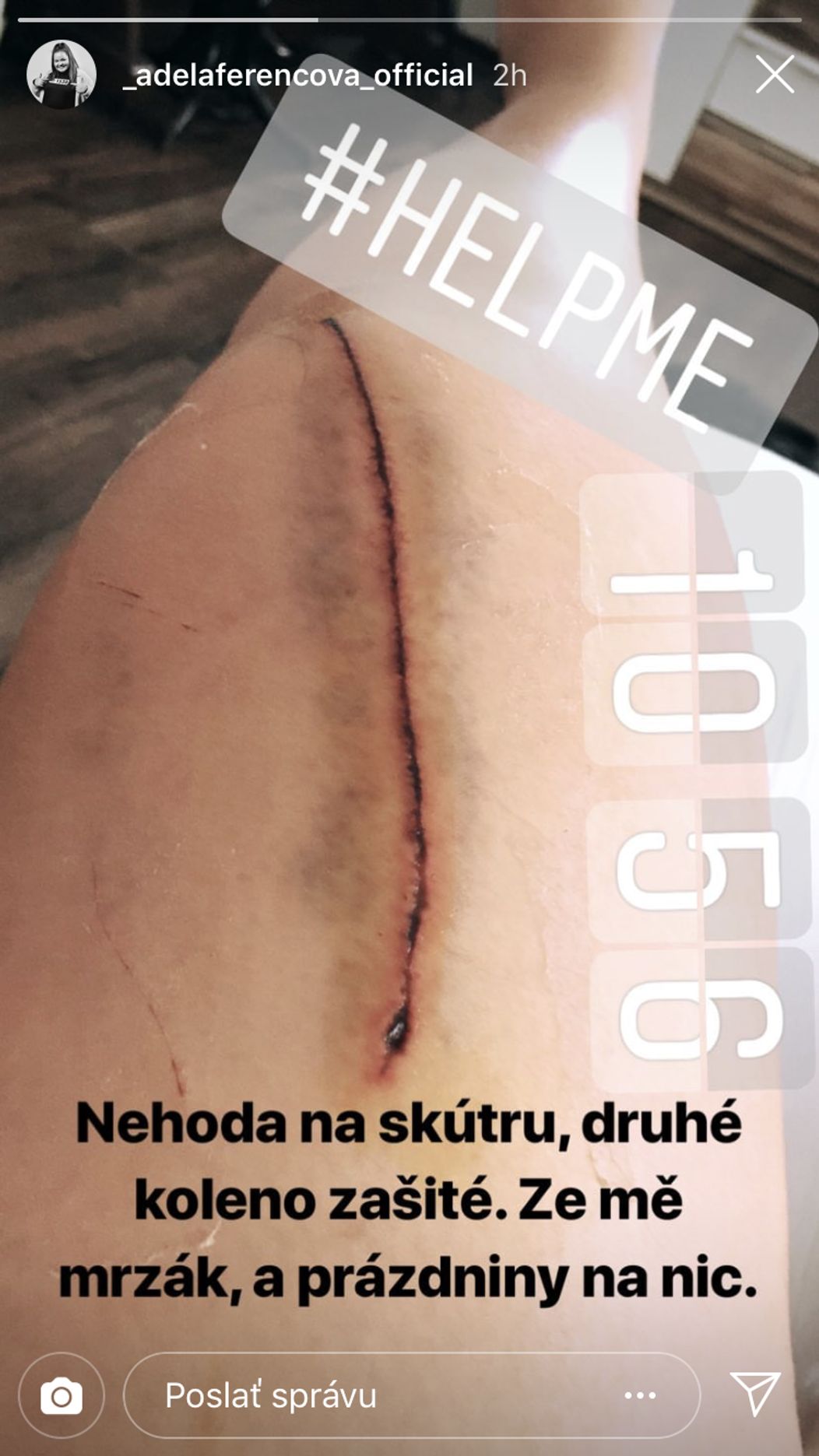 Bolestivé zranenie Adély Ferencovej