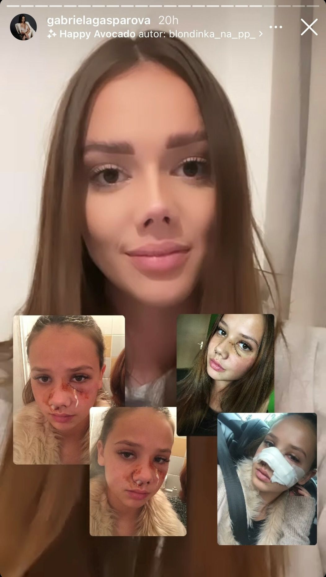 Gabriela ukázala hrozivé fotky po útoku psa.