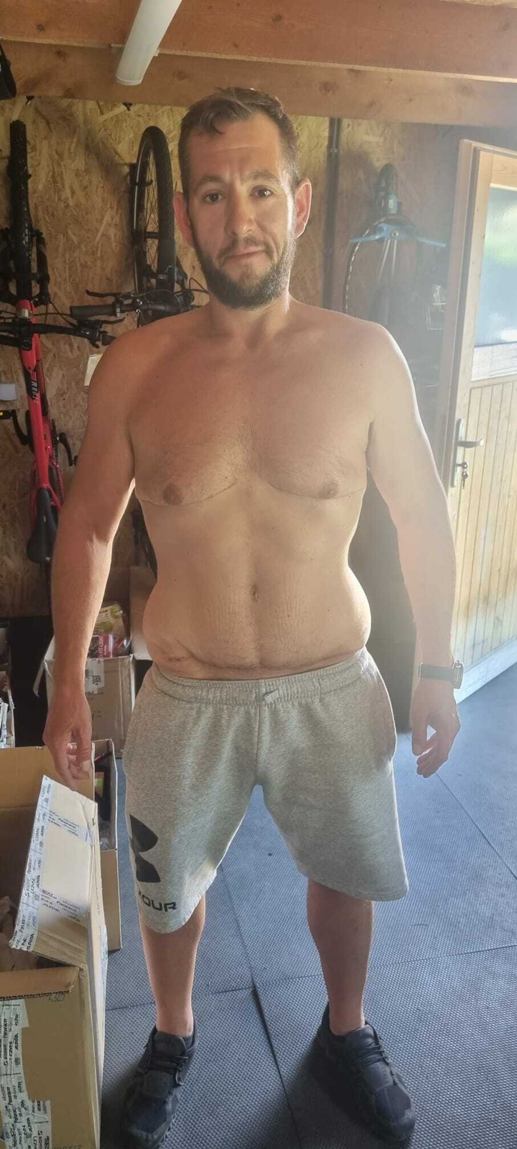 Andrej po operácii