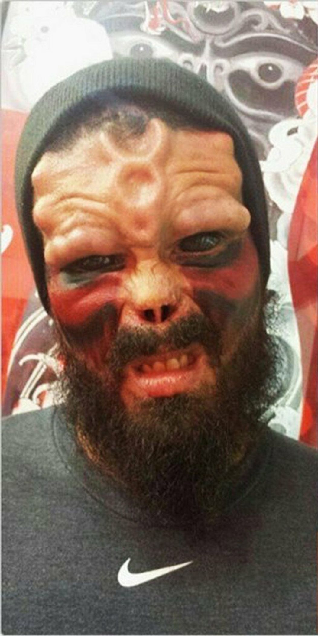 Russ Foxx sa považuje za kyborga. A navyše má aj rohy