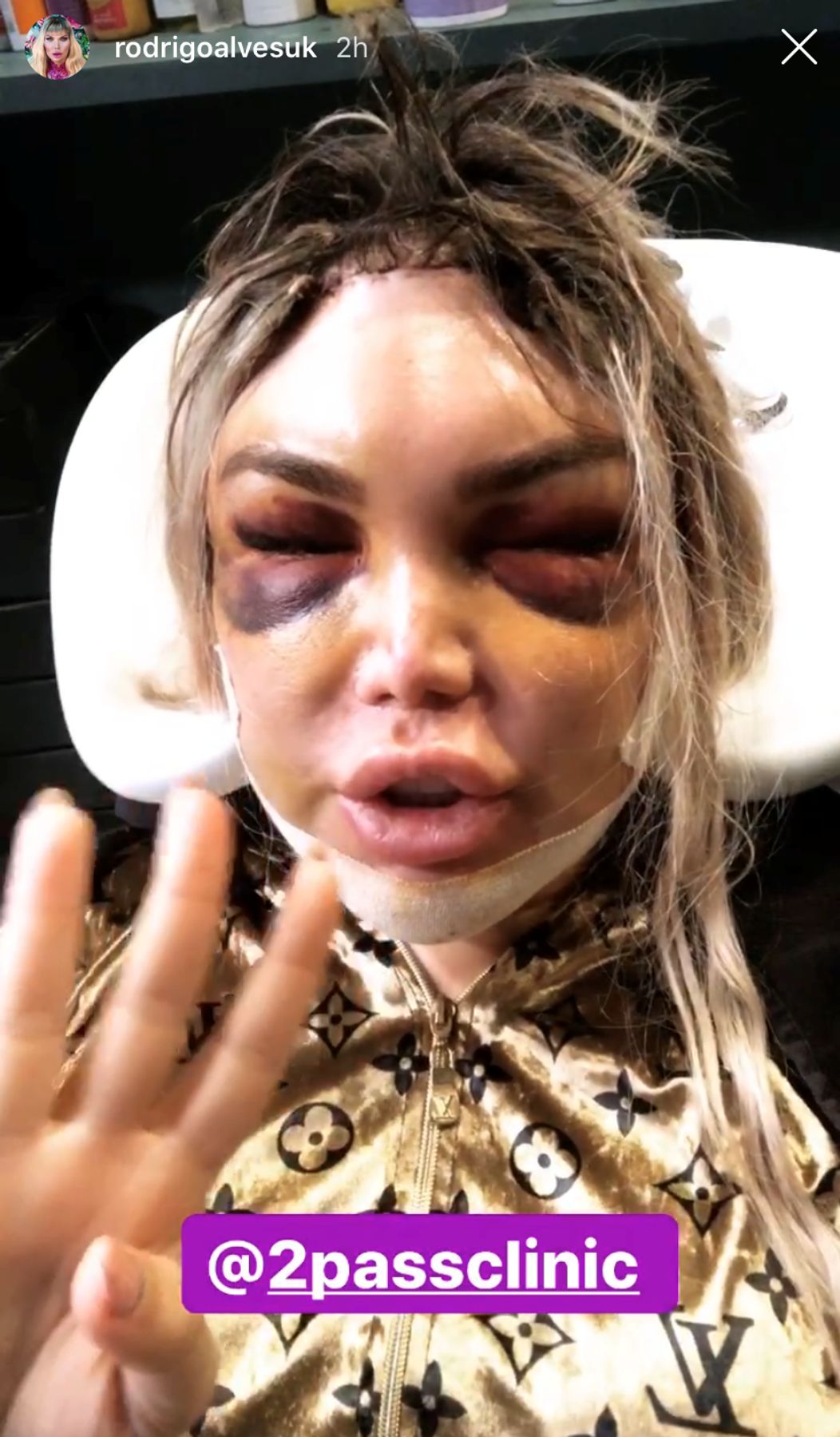 Ken sa mení na Barbie. 