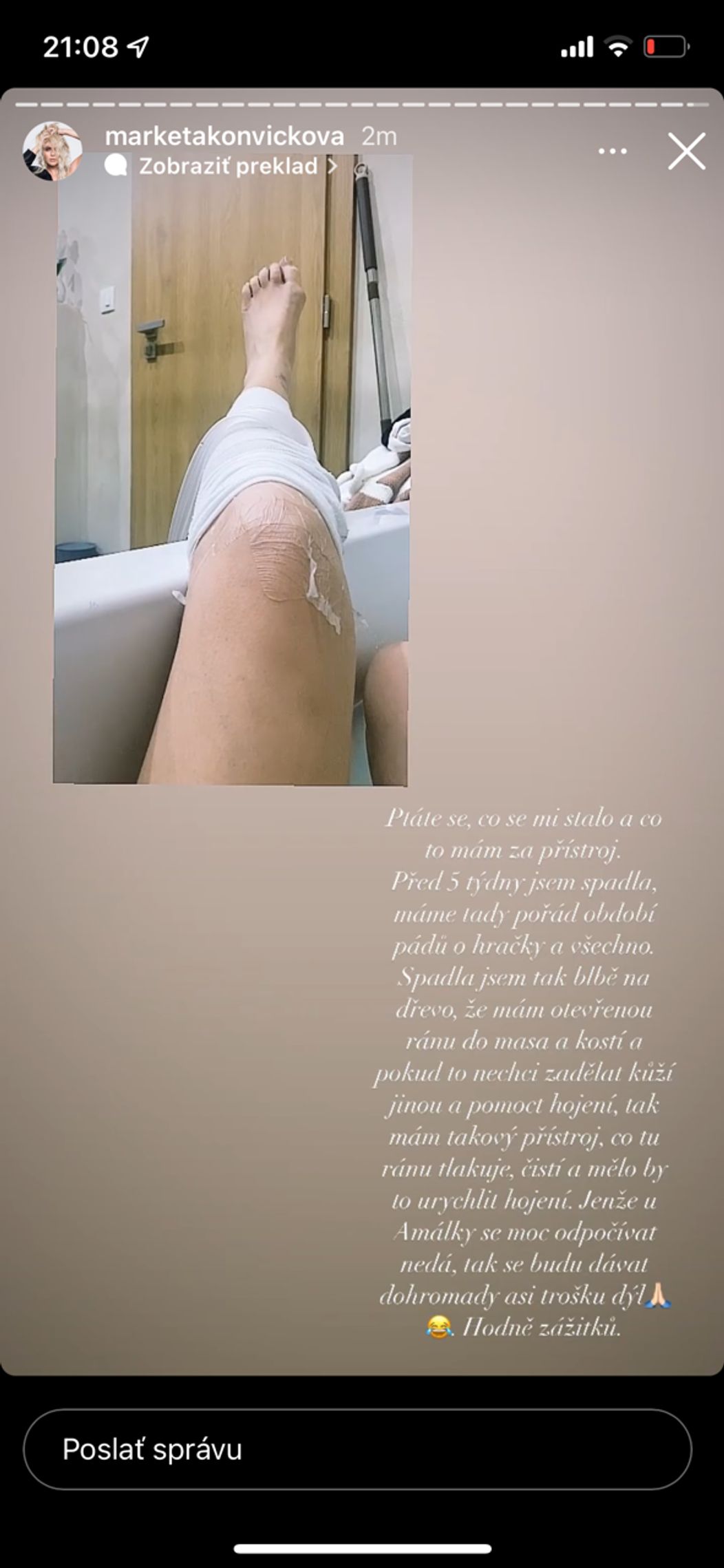 Markéta mala nepríjemné zranenie