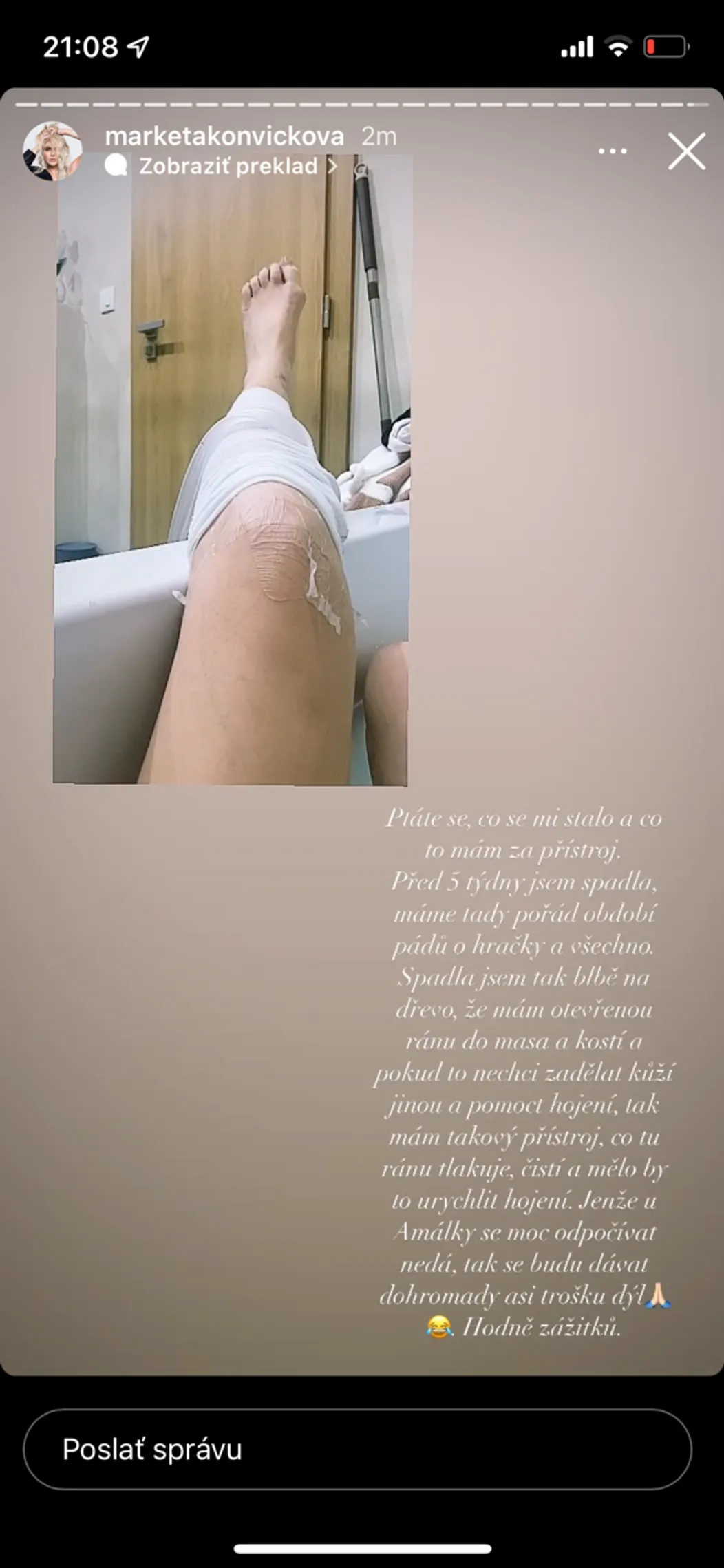 Markéta mala nepríjemné zranenie