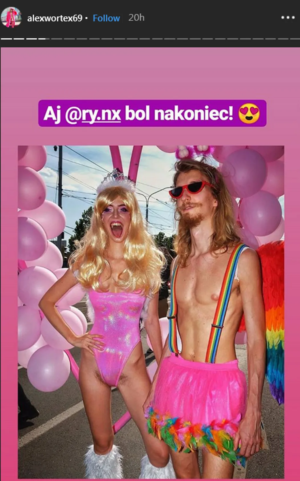 Sexy speváčka Dua Lipa ukázala frajera. Veď vôbec nie je neznámy
