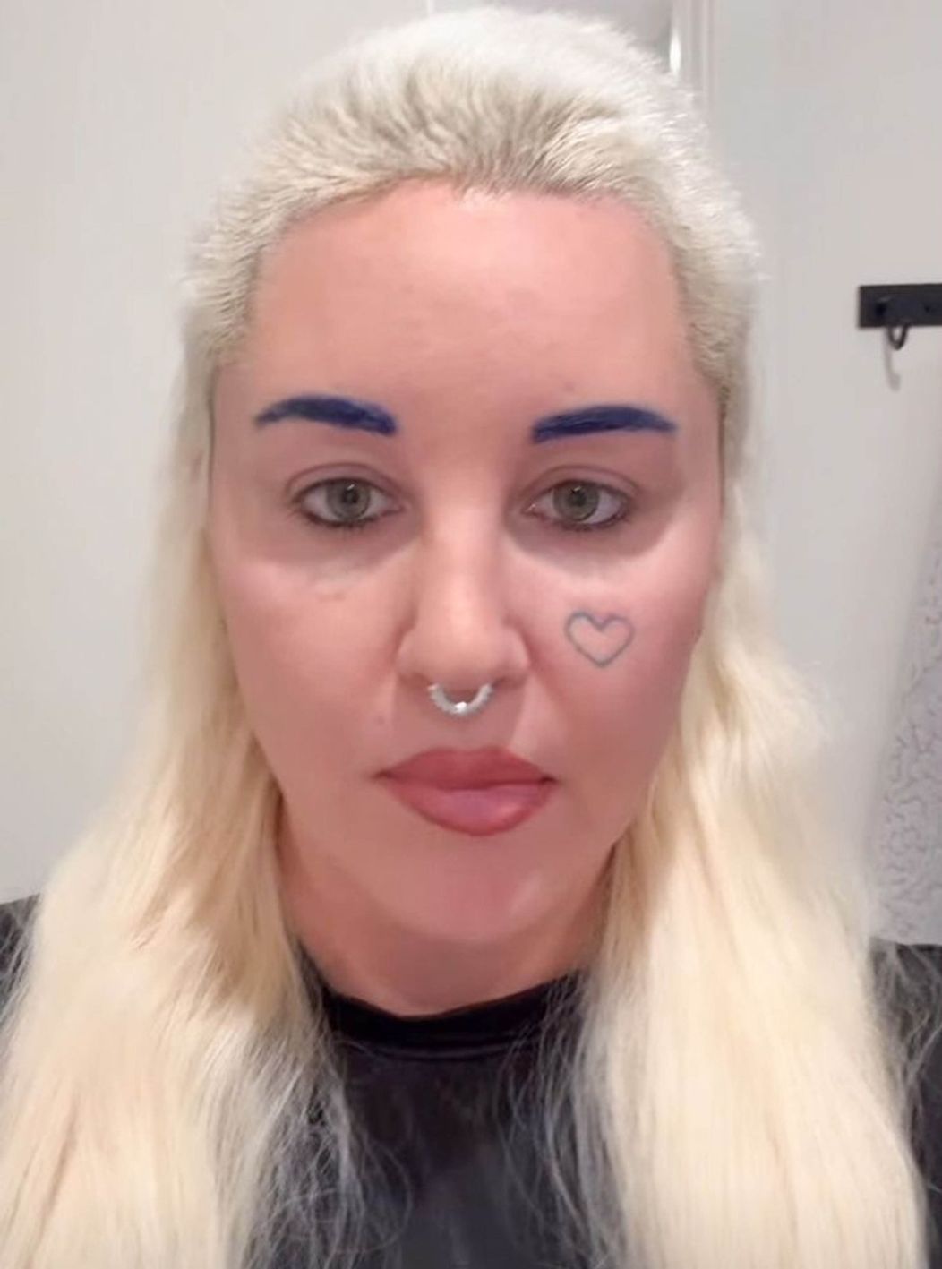 Amanda Bynes po operácii