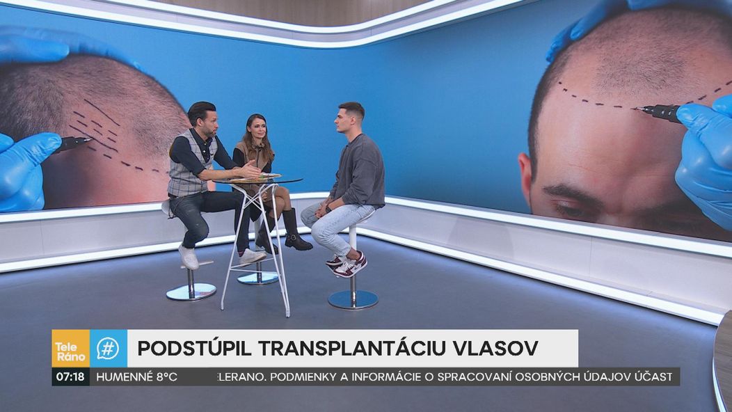 Martin Koči rozprával v Teleráne o transplantácii vlasov.