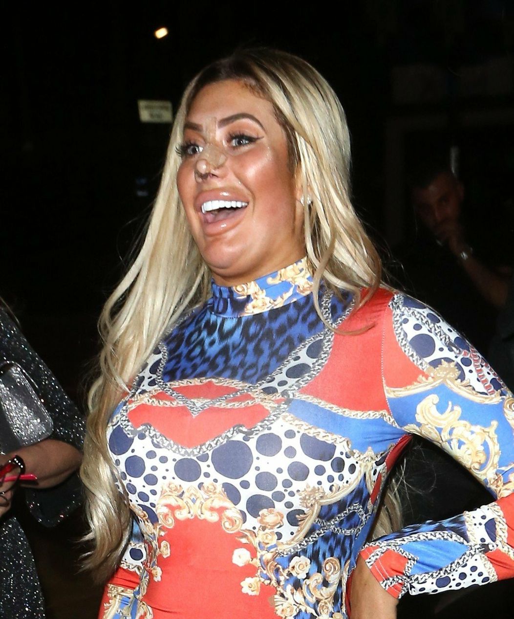Chloe Ferry po plastike nosa. 