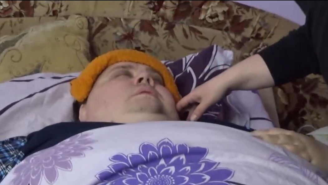 Ján Hodoň mal počas chudnutiazdravotné komplikácie