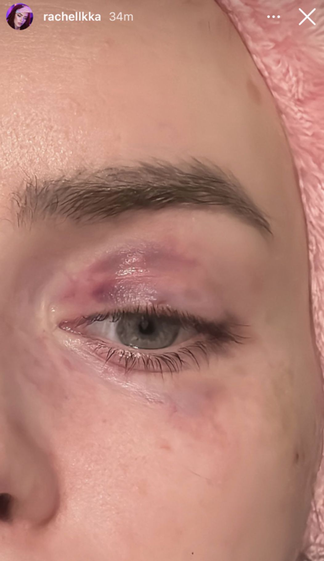 Ráchel Karnižová zverejnila fotky po bitke a správy plné vulgarizmov