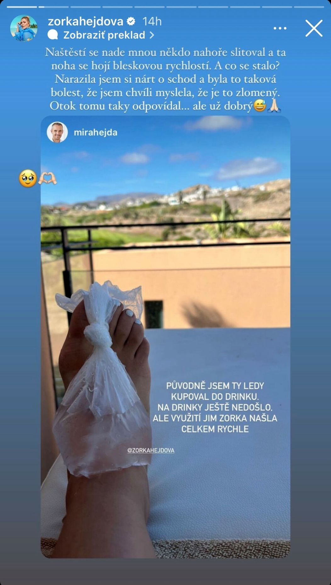 Zorke sa stal nepríjemný úraz.