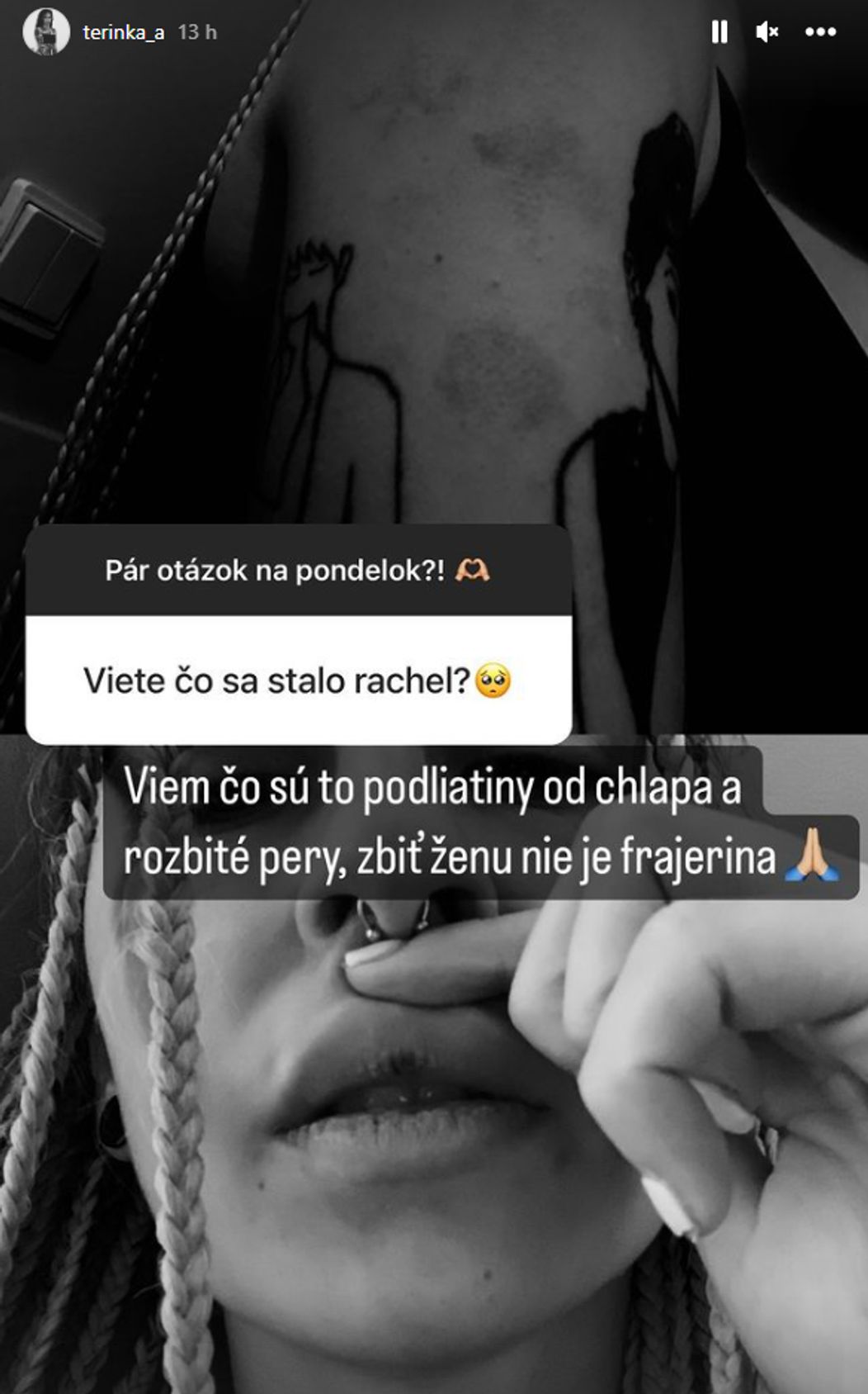 Tereza Kosecová zverejnila fotky po bitke