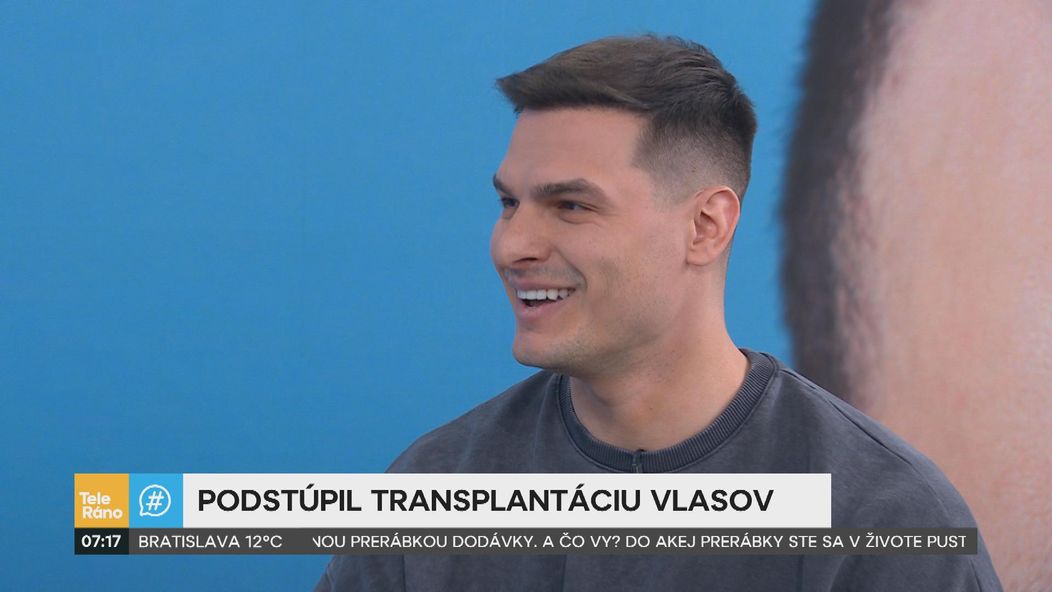 Martin Koči rozprával v Teleráne o transplantácii vlasov.