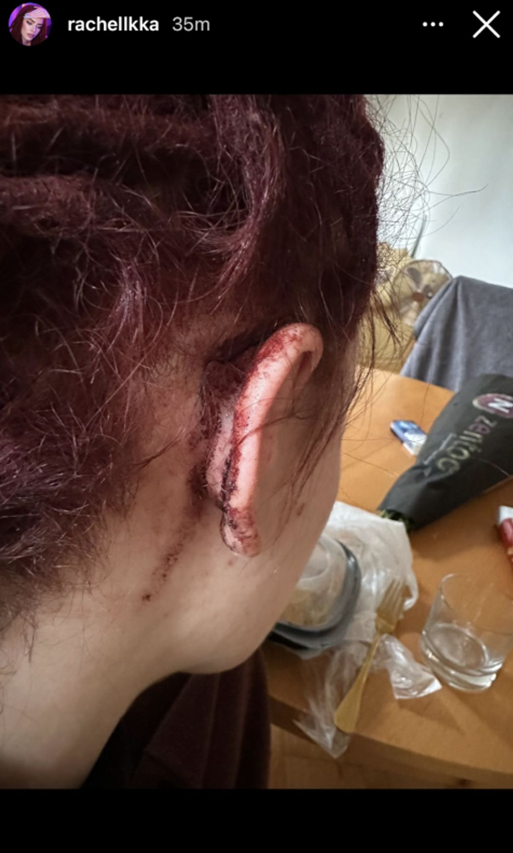 Ráchel Karnižová zverejnila fotky po bitke a správy plné vulgarizmov