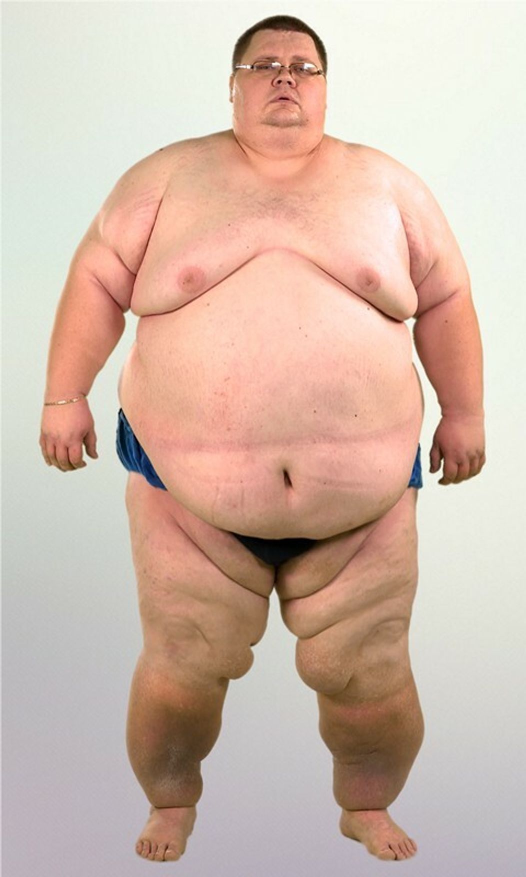 Ján Hodoň pred premenou vážil 287 kg