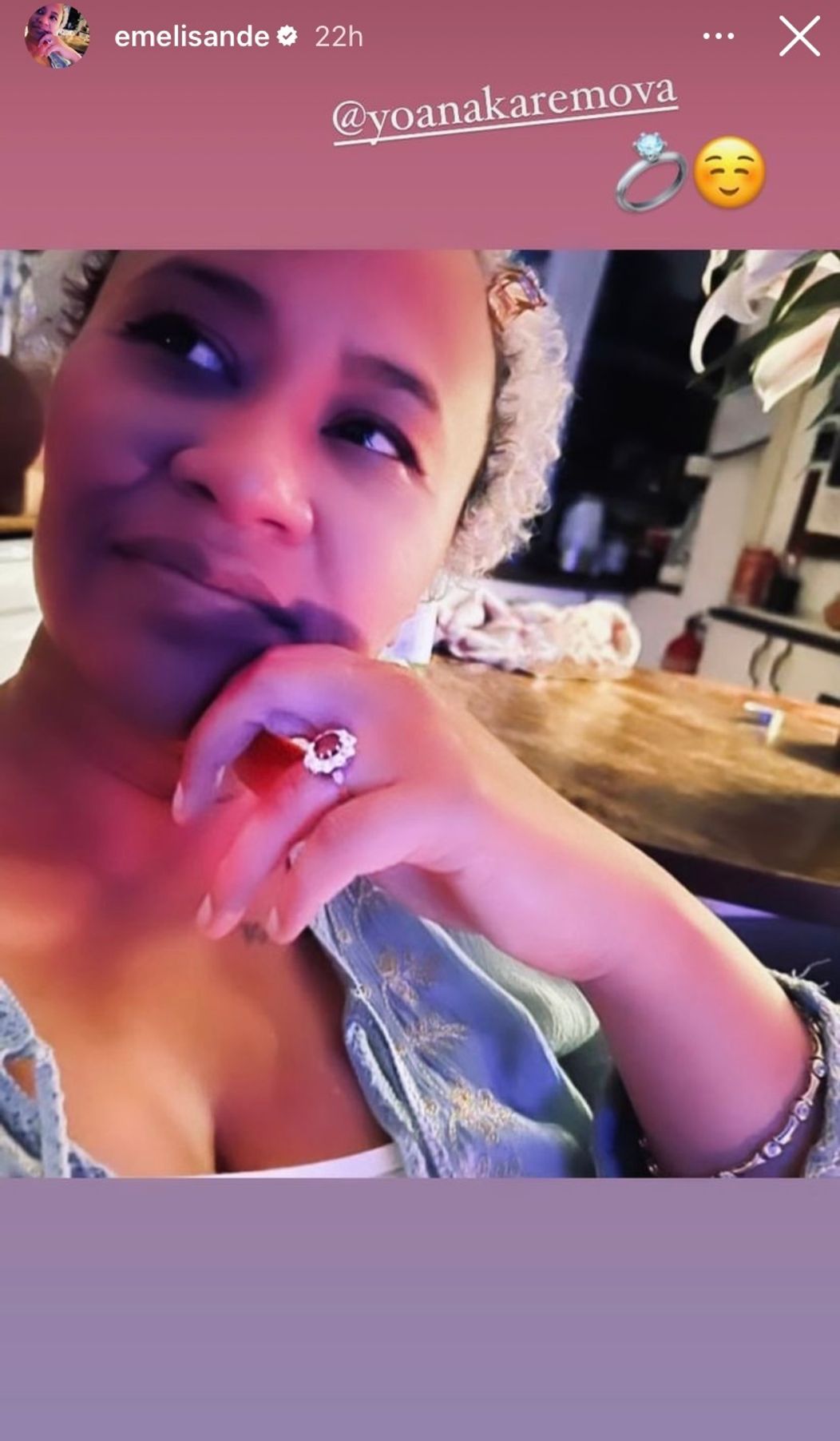 Emeli Sandé a jej snubný prsteň