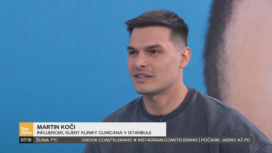 Martin Koči rozprával v Teleráne o transplantácii vlasov.