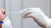 Testovanie odhalilo najviac pozitívnych prípadov za celý týždeň. Počet hospitalizovaných klesol