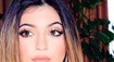 Len 16-ročná Kylie Jenner: Prerobený nos, napichaná pera a botox!?