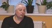 Odrazu jej začali padať mihalnice a vlasy. Až v susednom Česku sa dozvedela viac o tomto ochorení