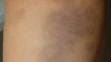 Policajná brutalita