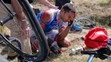 Zranený francúzsky cyklista William Bonnet (FDJ) si drží hlavu sediac na zemi po hromadnom páde, po ktorom odstúpil z TdF.