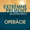 Extrémne premeny – Operácie