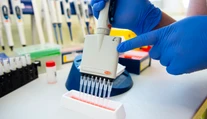 V laboratóriách potvrdili 155 nových prípadov variantu omikron na Slovensku