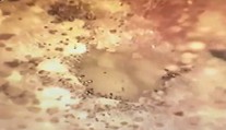 VIDEO: Pacient sa sťažoval na nedoslýchavosť. Keď lekár prezrel ucho, zostal v šoku