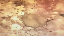 VIDEO: Pacient sa sťažoval na nedoslýchavosť. Keď lekár prezrel ucho, zostal v šoku
