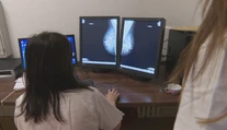 Sono prsníka minulosťou? Sme rodina navrhuje vypustiť ho z preventívnych vyšetrení