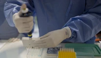 Vedci objavili účinné antibiotikum. Dokáže zničiť viacero doteraz odolných baktérií