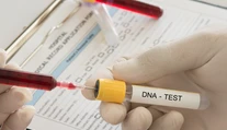 Matka si zo zvedavosti dala urobiť test DNA. Zistila, že 12 rokov vychováva cudzieho syna