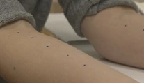 Vedeli ste, že na testy na alergiu nemusíte čakať do zimy?