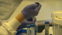 Slovenskí vedci objavili nový proteín, ktorý opravuje poškodenú DNA