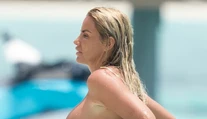 Osem operácií poprsia urobilo svoje. Modelka jazvy neskryje