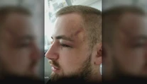 Prípad údajnej policajnej brutality v Košiciach. Je tu aj iná verzia, vraj si muž zranenia spôsobil sám