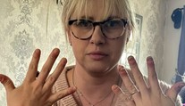 Žena roky nosila gélové nechty, teraz to horko ľutuje. Znetvorené prsty už takmer nedokáže ohnúť