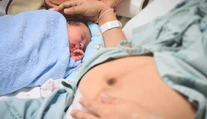 Deti narodené cisárskym rezom majú väčšiu šancu, že budú obézne a budú mať diabetes