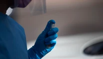 Nový test odhalí rakovinu roky pred jej prejavmi. Má vysokú mieru úspešnosti